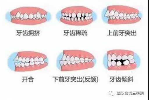 南通种植牙哪家医院好？南通排名前五牙科种牙便宜还正规